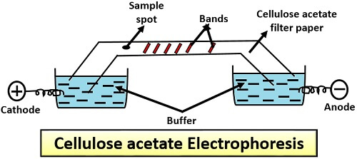 cellulose acetate electrophoresis