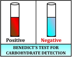 benedict's test