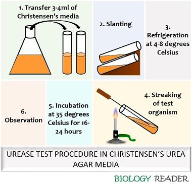 Protocol of urease test in Christensen's media