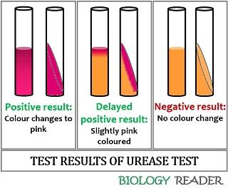 Test Result Of Urease Test