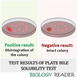 Test result of bile solubility test by plate method