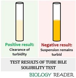 Test result of tube bile solubility test