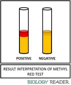 result interpretation of MR test