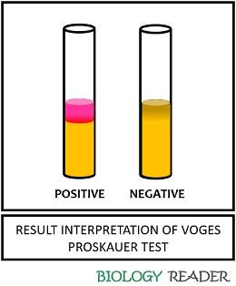 result interpretation of VP test