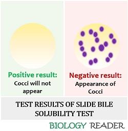 test result of bile solubility test by slide method