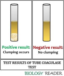 tube coagulase test